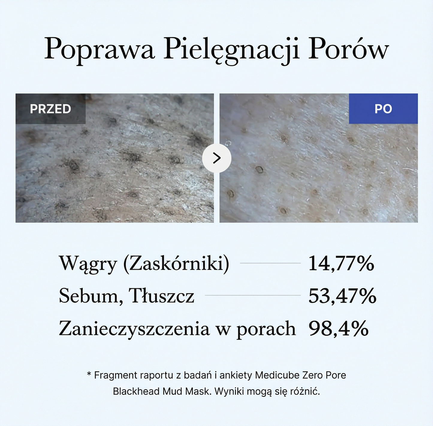 Maseczka błotna Zero Pore na wągry