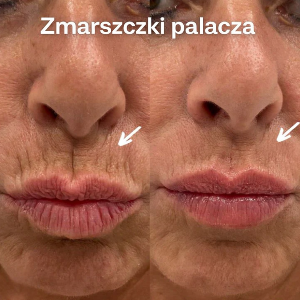 Odmładzający Balsam wieloskładnikowy z wapniem