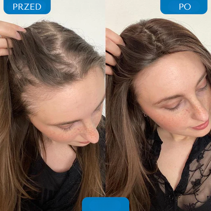 Serum na porost włosów