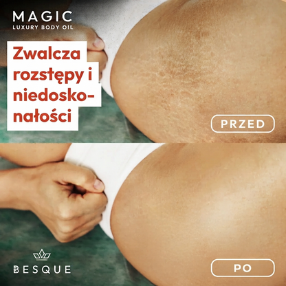 Besque – Ujędrniający Olejek do Ciała | 7 olejów tłoczonych na zimno