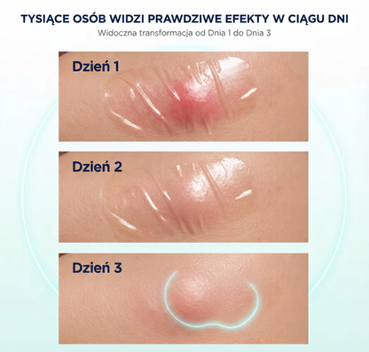 Hydrokoloidowy plaster w rolce – opatrunek chłonny do wilgotnego gojenia ran