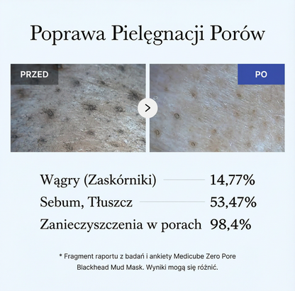 Maseczka błotna Zero Pore na wągry