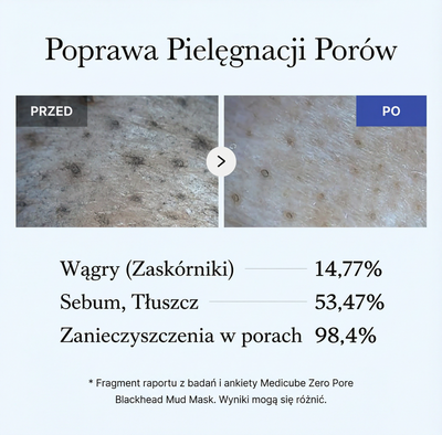 Maseczka błotna Zero Pore na wągry