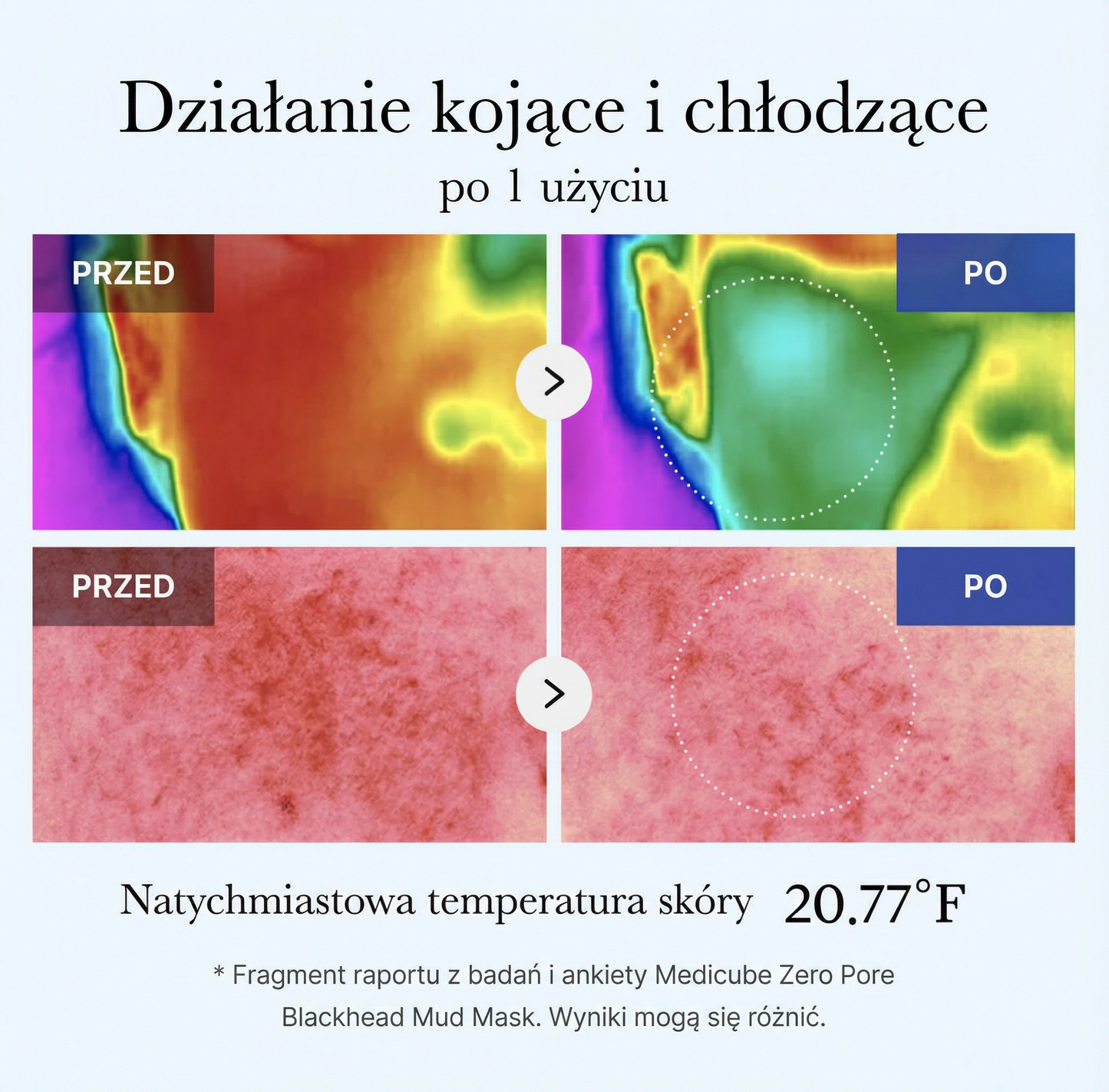 Maseczka błotna Zero Pore na wągry