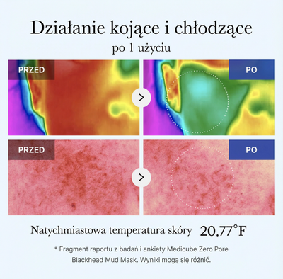 Maseczka błotna Zero Pore na wągry